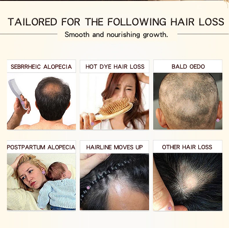 30 мл OEDO Сыворотка для роста волос, марокканская травяная эссенция для восстановления корня волос, травяное лечение женьшеня, выпадение волос, быстрый мощный Уход за волосами