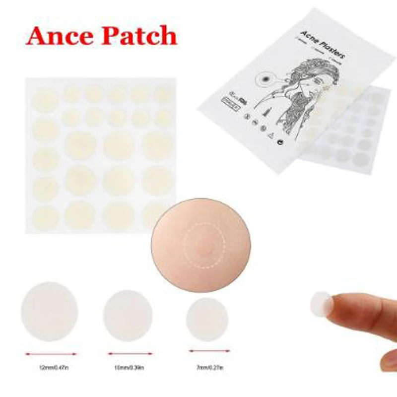 ance patch
