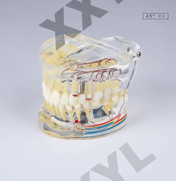 

Human Dental laboratory teeth teach Standard Typodont Full Pathology Model with Gingiva implant equipment juguetes dentales