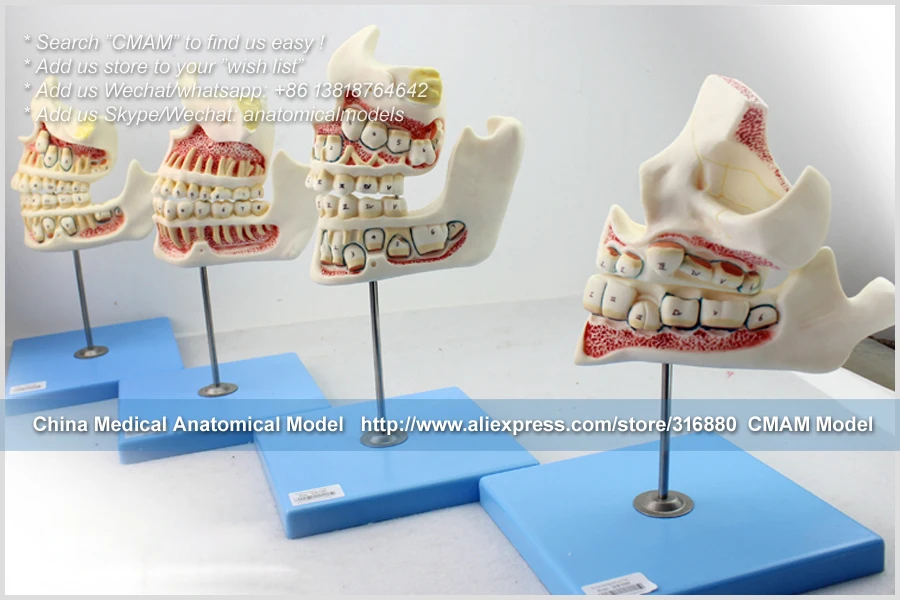 CMAM/12604 Dental-Development of the set of Teeth, Human Oral Dental медицинская обучающая анатомическая модель