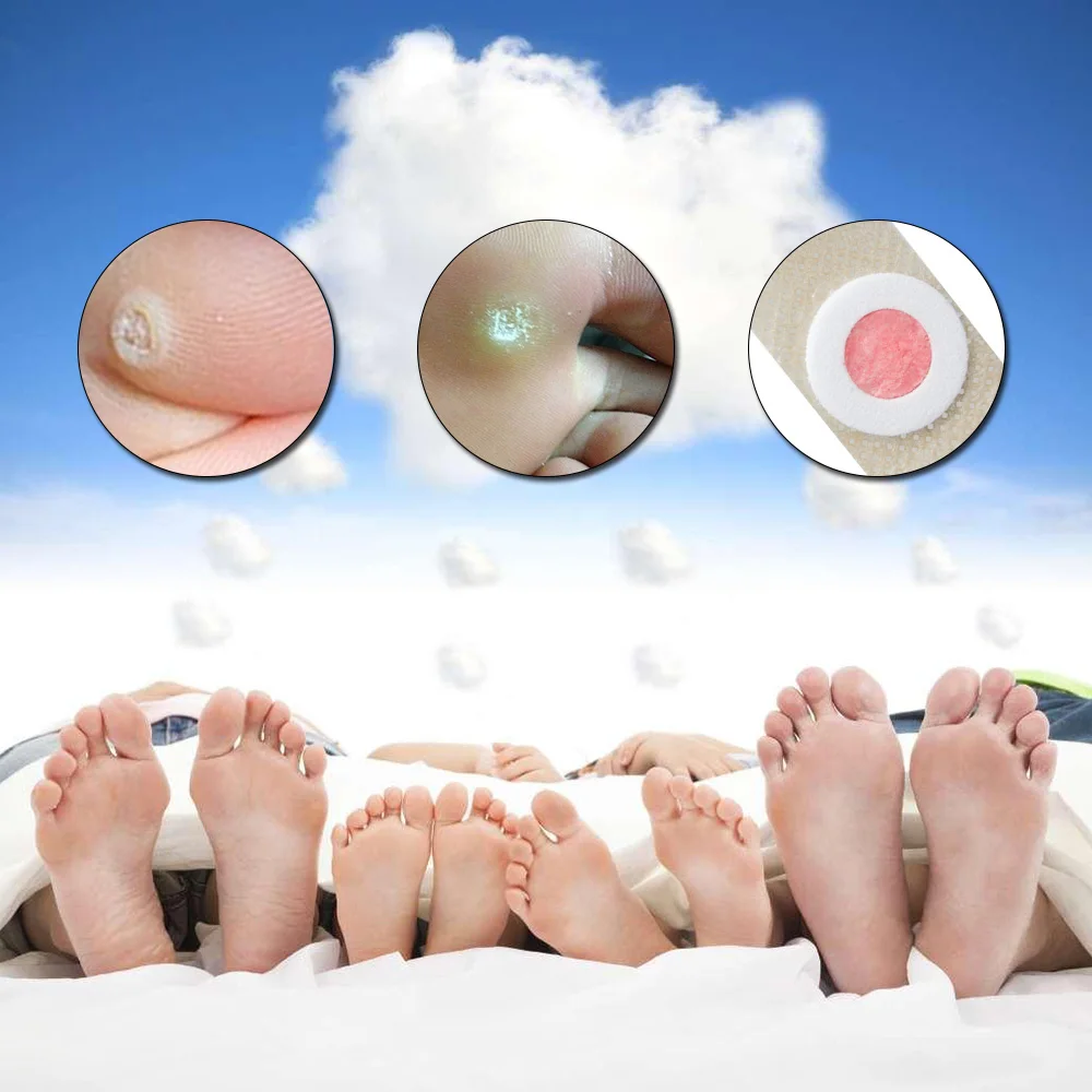 

36Pcs/Box Foot Corn Removal Plaster Feet Callus Remove Soften Skin Cutin Sticker Cure Toe Protector with Hole Warts Thorn Patch