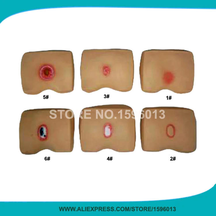 Модели декубитуса модель ухода за кожей ягодиц декубитус|nursing model|pressure soreskin model |