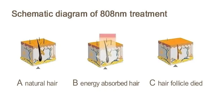 808нм Диодная лазерная машина для удаления волос с двойной головкой 5000000 снимает постоянный лазерный эпилятор и уход за кожей Отбеливающий дивиз