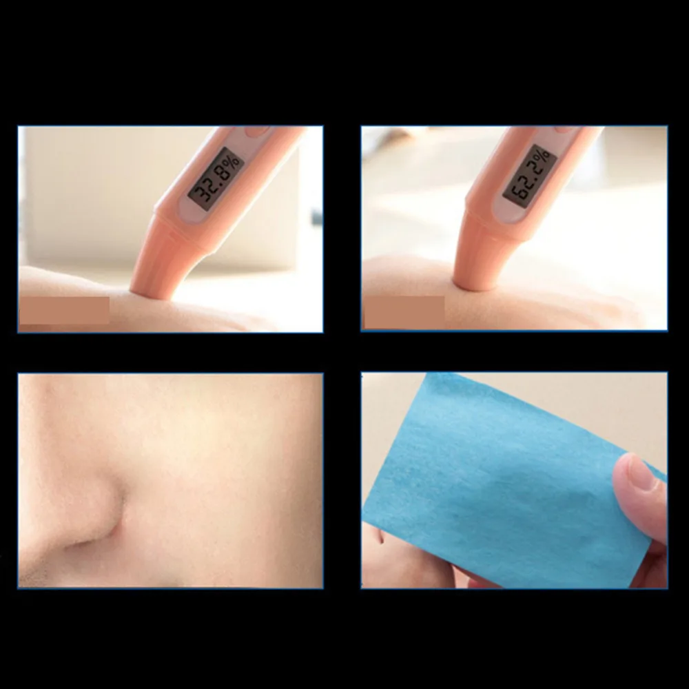 Отбеливание увлажняющий масло-контроль Уход за кожей лица крем лечения акне Для мужчин t Гиалуроновая кислота Anti-Aging facail Уход за кожей крем для мужчин