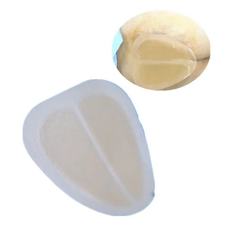 

Size 6"X 7" Survival Medical Adhesive Sacral Bordered Hydrocolloid Wound Dressing For Sacrococcygeal decubitus Care Plaster
