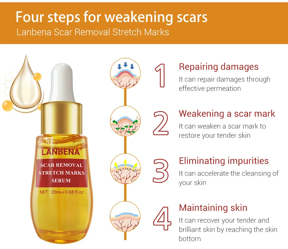 Средство для удаления растяжек LANBENA удаляет рубцы после акне Сыворотка для лечения акне против угревой сыпи сужение пор ремонт пор Pockmark крем для ухода за кожей