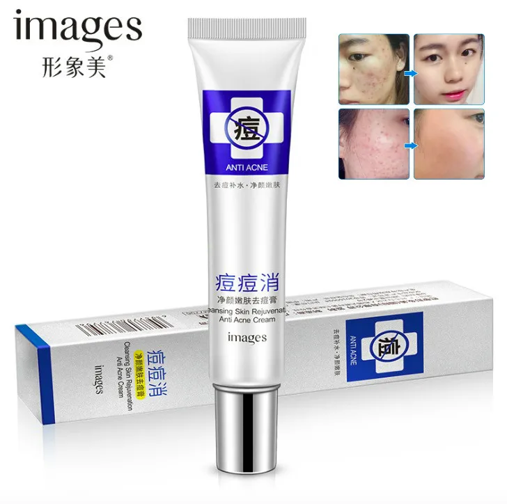 30g Images Acne Scar Remove Acne Treatment Shrink Pores Gel Bleaching