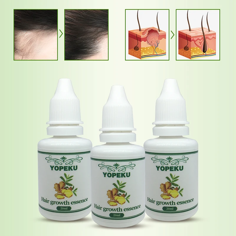 

3PCS Natural Original Fast Hair Growth Liquid Hair Regenerating Essence Anti Hair Loss Products Repair Treatment Hair Root Care