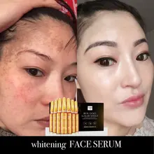 7pcs beauty nicotinamide essence moisturizing face serum facial skin care female products Whitening lifting visage spa beauty salon products snow whitening rejuvenation white replenishment moisturizing essence anti freckle 1000ml