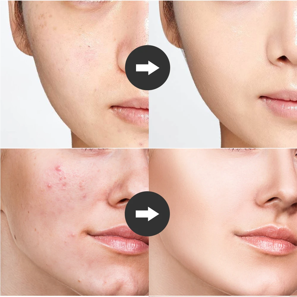 Tubo de Vidro Cuidados com a Pele Alta Frequência Eletrodo Eletroterapia Dispositivo Beleza Facial Acne Manchas Rugas Removedor Spa Salão Casa 18 dispositivo beleza cuidados com a pele facial