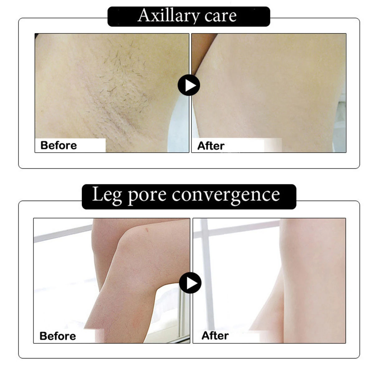 Натуральный Подмышечный осветление отбеливание крем для ног на коленях увлажняющий Восстанавливающий отбеливающий крем уход за кожей тела 50 г
