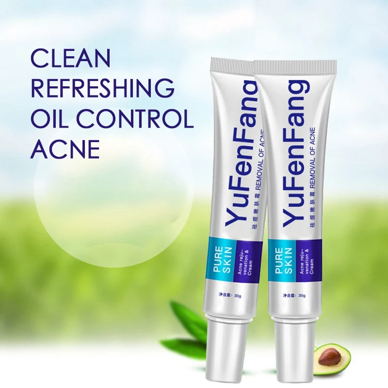 30g Acne Treatment Blackhead Remove Day Cream Anti Acne Cream Oil