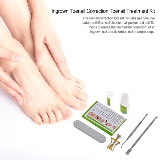 Ingrown Nail Treatment 6pcs ingrown toenail correction kit toenail treatment nail glue toe nail pedicure elastic patch pusher foot