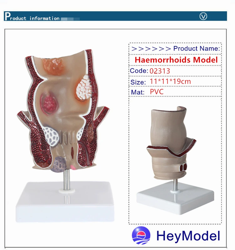 Heymodel человека геморрой модель