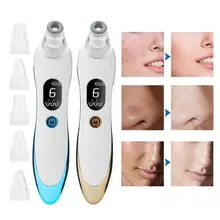 2 цвета микрокристаллический Удаление угрей вакуумное Очищение лица пористая кожа инструмент для очистки средство для устранения черных точек очиститель пор инструмент