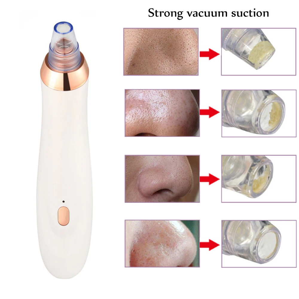 Murah Perawatan Kulit Pori Vacuum Komedo Remover Jerawat Jerawat Penghapusan Vakum Pori Cleaner Minyak Kutikula Menghapus Facial Komedo Extractor