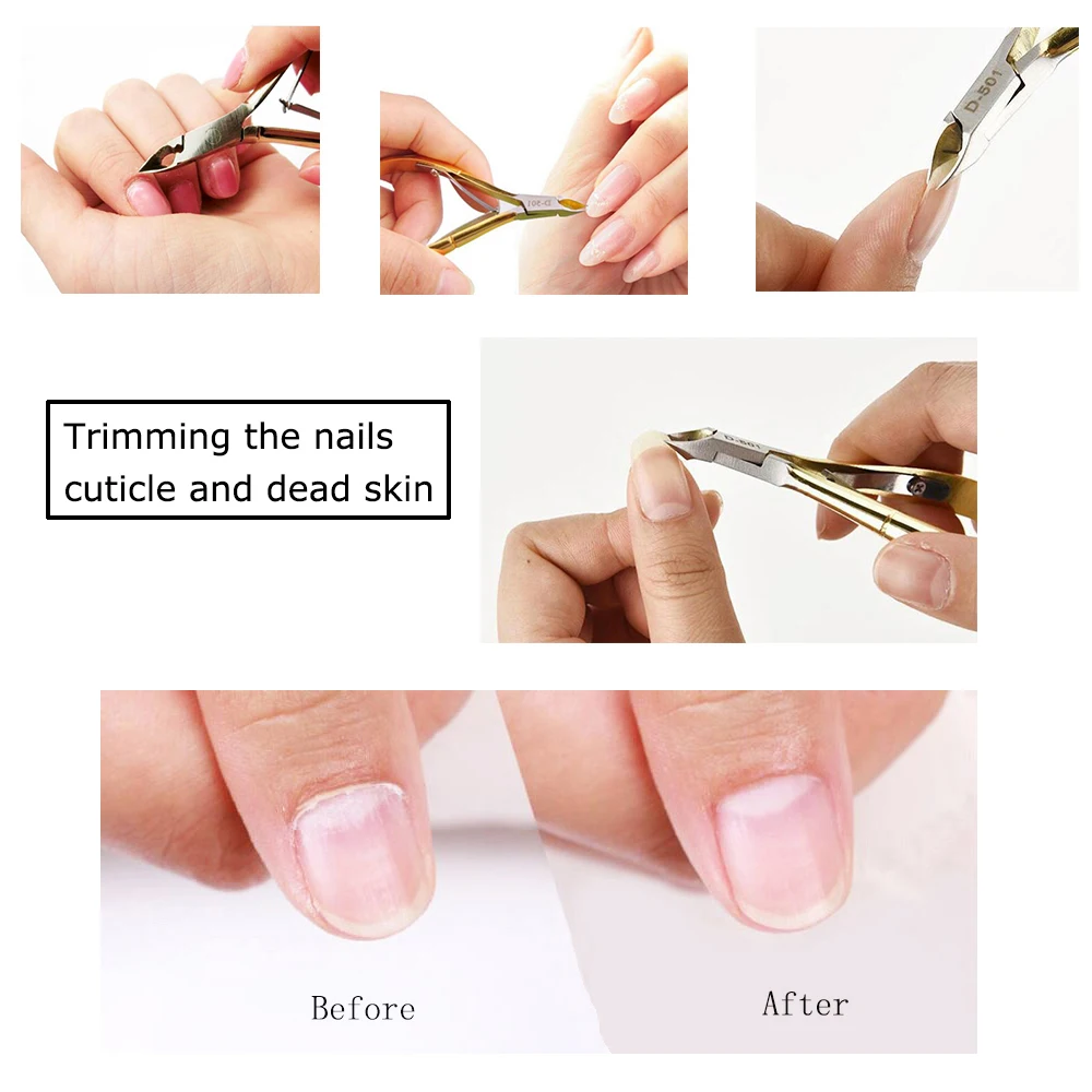 Nail Nipper  (5)