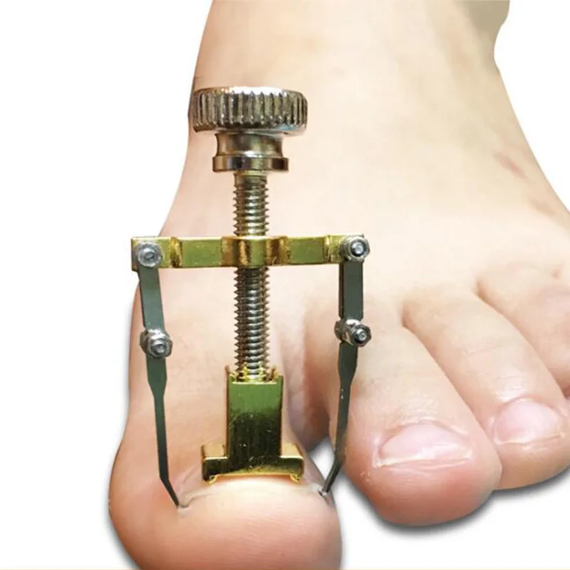 

Pedicure Tool Ingrown Toe Nail Corrector Paronychia Chiropody Podiatry Foot Care Repair Nail Clipper