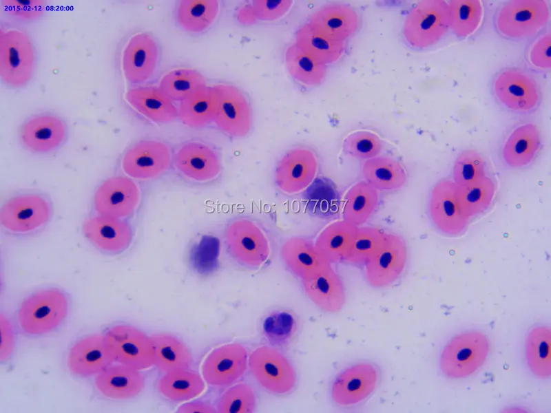 18_Blood_of_frog_smear