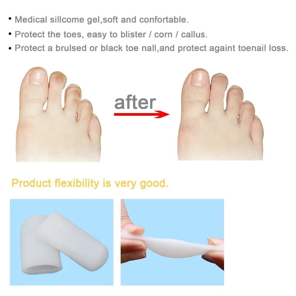 5 пар силиконовых носочных втулок для ног, облегчающая боль, защитная крышка для мозолей, деформация вальгусной деформации, выпрямитель для пальцев ног