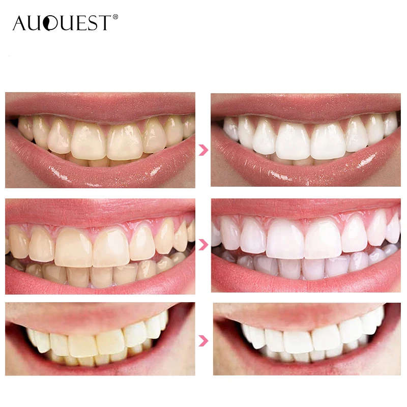 AuQuest 3D 7 шт. белый гель Отбеливание зубов полоски для зубов, зубная набор отбеливание зубов белее полоски первой необходимости оральное отбеливание зубов