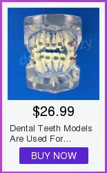 Modelo de Gesso Molde de Base de Silício Dental Bloco Completo-roxo Suprimentos Edentulous Jaw 2 Pçs - Set 35 Modelo de Ensino Dental