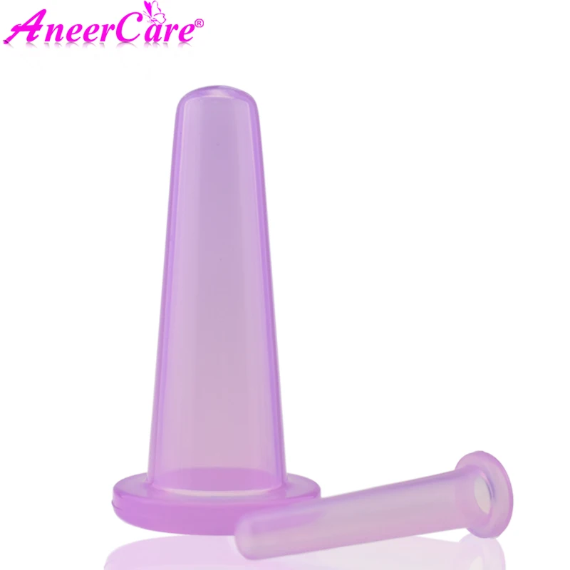vacuum cupping-1