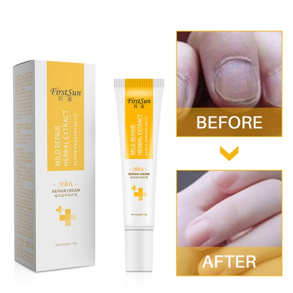 Firstsun 15g Natural Herbal Toe Nail Repair Cream Fungus Treatment