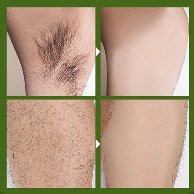 

NEW Painless Depilatory Hair Removal Cream Natural Plant Extract for Body Leg Armpit