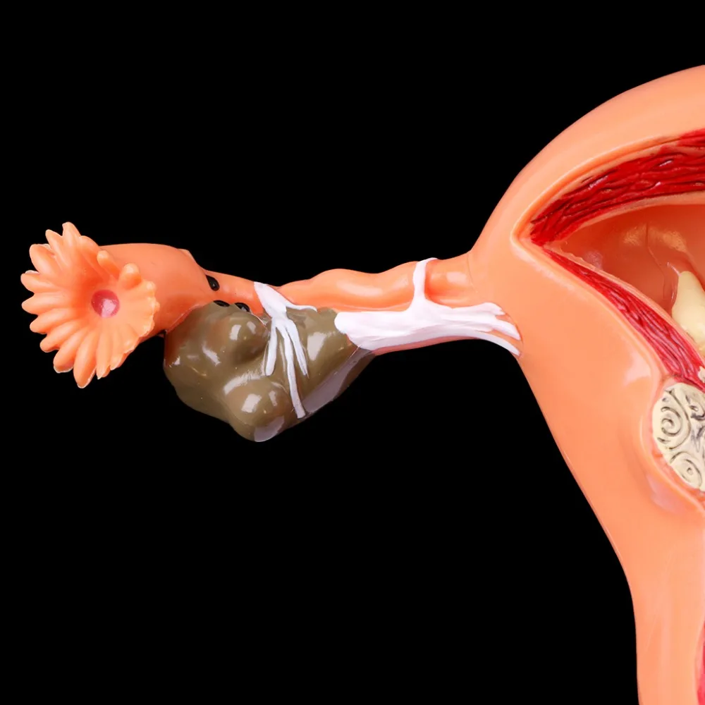 Патологическая матка яичник анатомическая модель Анатомия поперечного сечения инструмент для исследования