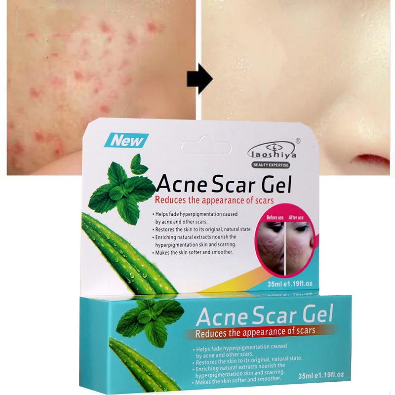 Aloe Vera Gel face Cream Whitening Skin Care Anti Acne Treatment Cream