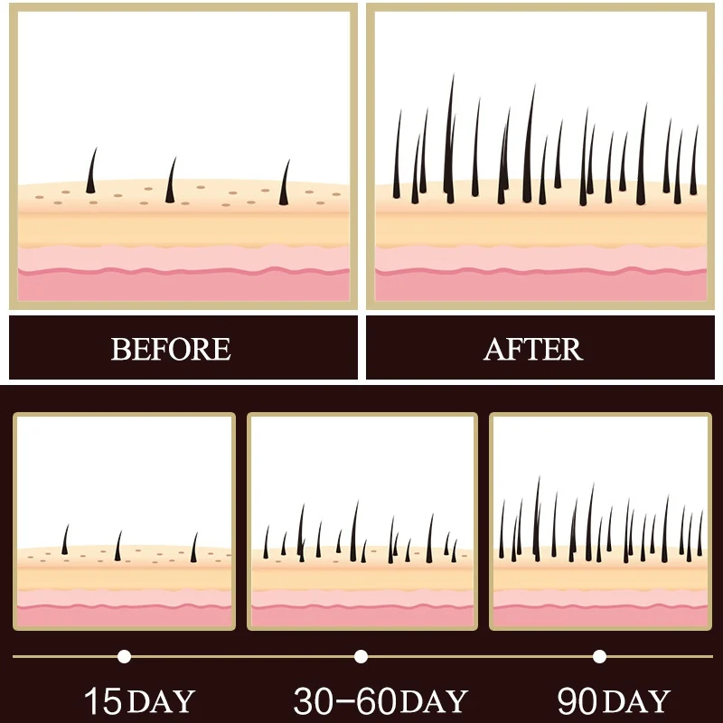 Средство для роста волос питательные волосяные фолликулы кожи головы ускоряют рост волос против выпадения волос жидкость