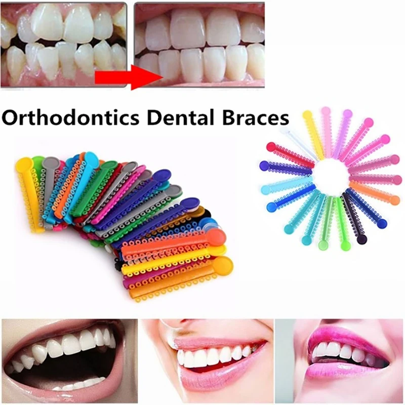 40 Pcs Bright Color 2018 new Bands Teeth Care Dental Elastomeric