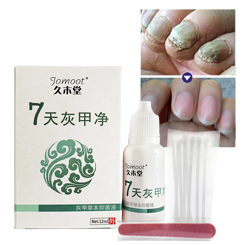 

New Toe Finger Nail Fungus Treatment Anti Fungal Infection with Cotton Swabs 998 Clean Kit