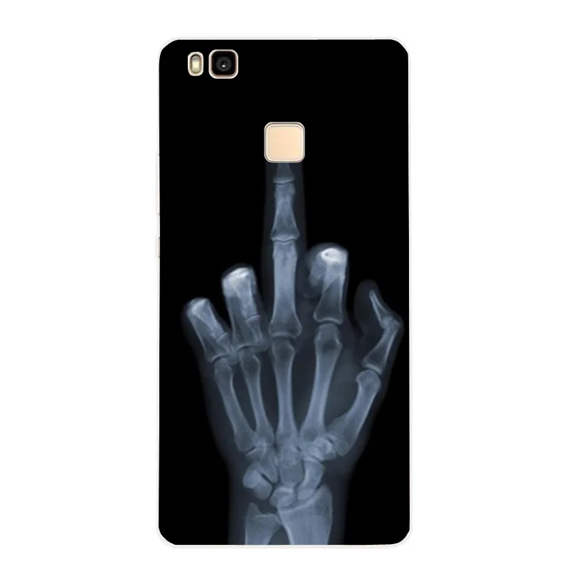Flower Case Ultra Thin Soft Silicon TPU Cover Coque For Huawei P8 Lite  (1)