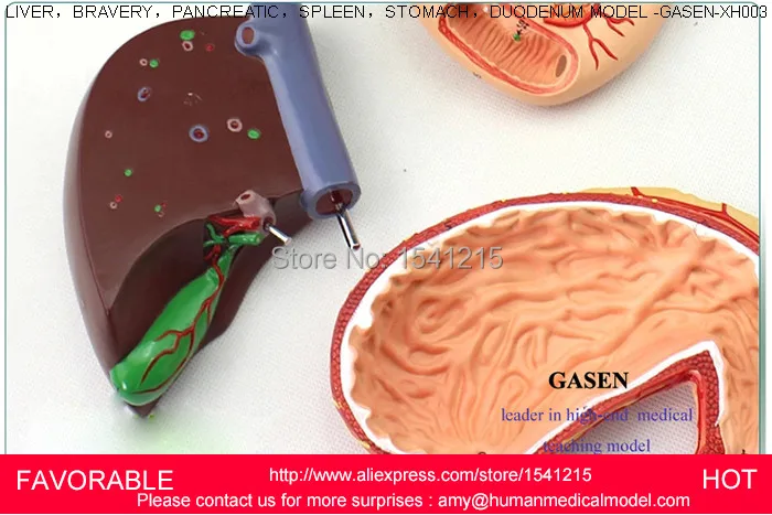 Фигадо печень поджелудочная кистозная структура модель медицинский анатомический пищеварительный желудок гепатобилиальный желудочно-кишечный GASEN-XH003