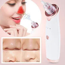 4 в 1 вакуумный Электрический ингалятор от угрей Удаление пор очиститель маска для носа против черных точек пятна Cutin прибор для глубокой чистки лица черная голова 2 цвета