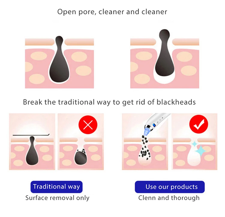 Removedor de Sucção a Vácuo para Aspirador de pó para Limpeza Facial Pore Cleaner Cravo Acne Pimple Remover Tool Pontos Pretos 11 Tool Removedor de Sucção A Vácuo para
