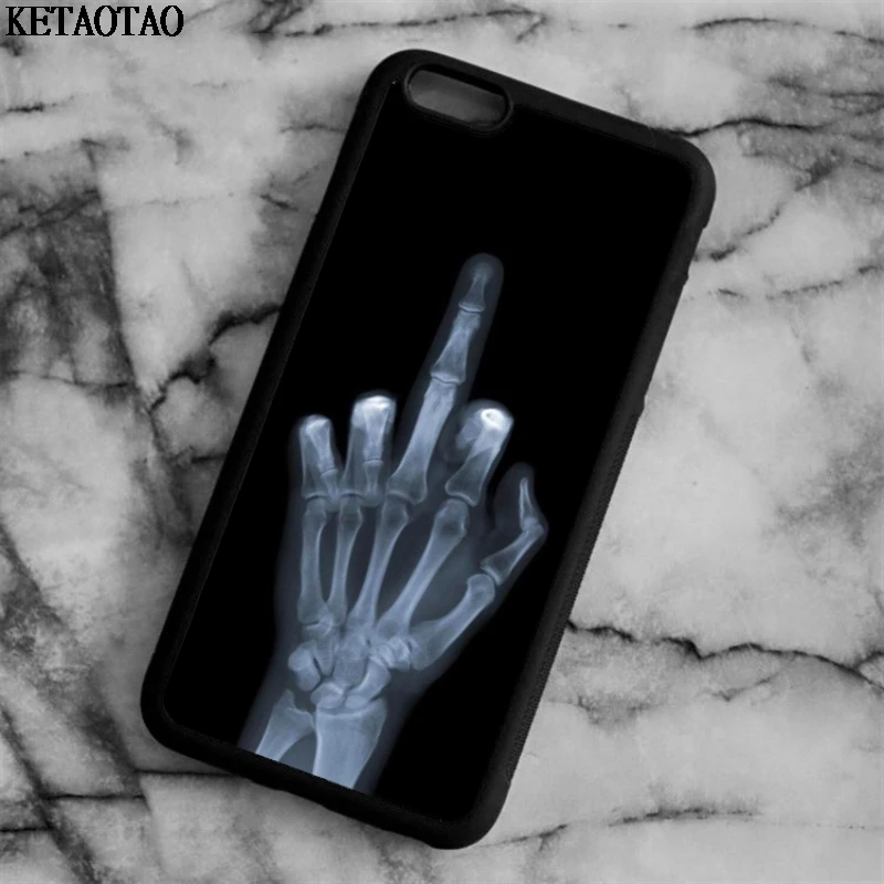 Котик с факами чехол для айфон. Прикольные чехлы на айфон. Чехол с факом. Котик с факом чехол. Котик с факом чехол.