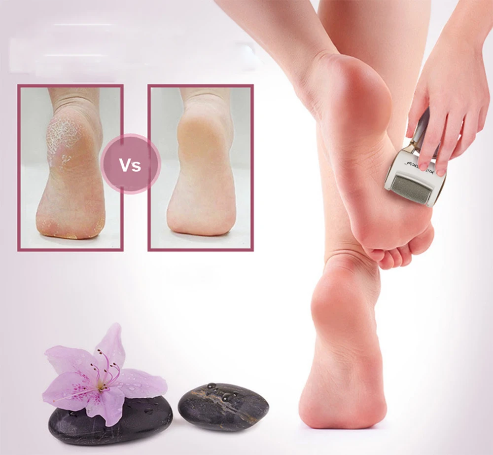 Ferramenta de Cuidados com os Pés Removedor de Pele Kimisky Luxo Recarregável Pedicure Cuidados Pessoais pé Esfoliante Elétrica Pés Morta Cabeças Rolo 28 os pés pedicure cuidados pessoais pé esfoliante