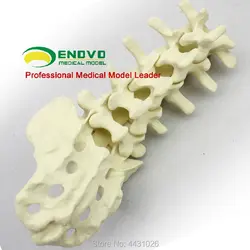 ENOVO ортопедической хирургии Кости Модель Sawbone человека bone модель в ортопедической хирургии