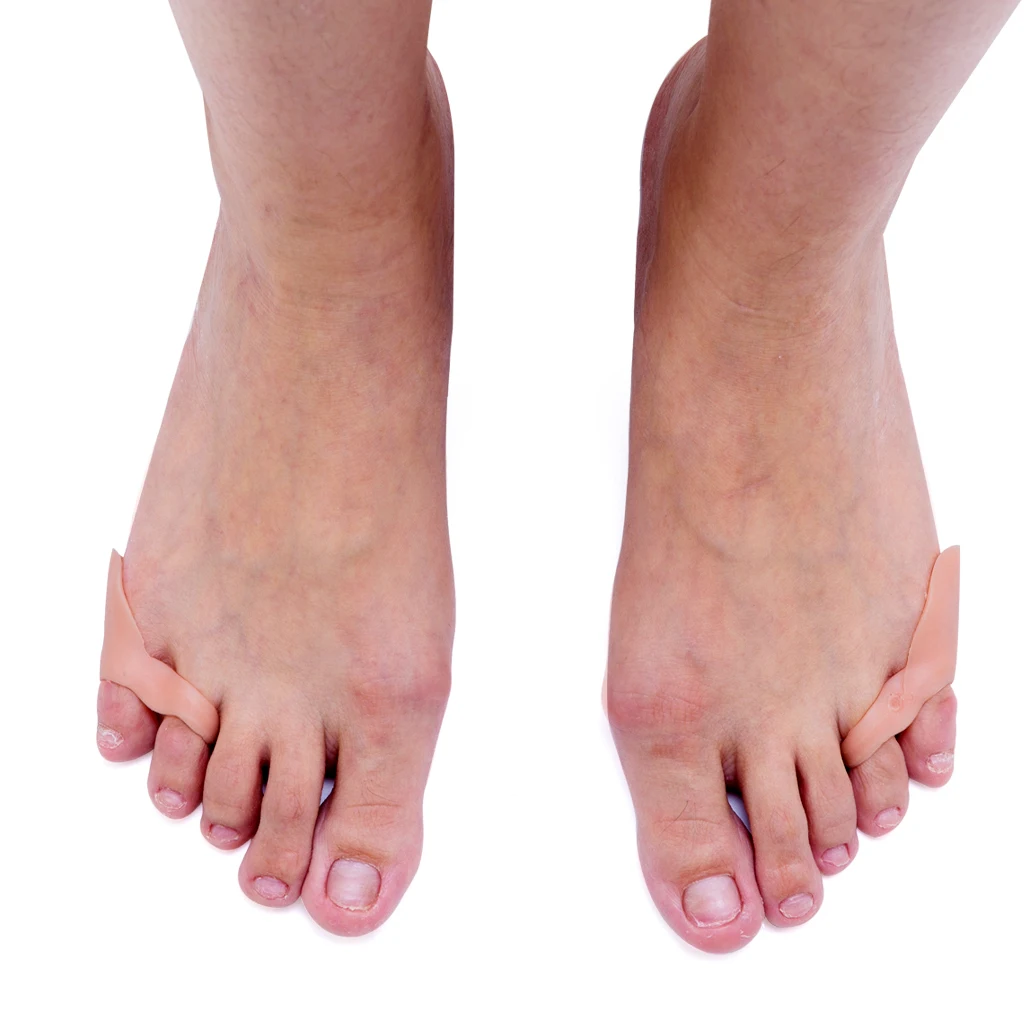 1 Pair Gel Little/Pinky Toe Straightener Separators Bunion Corrector Skin Feet Care Foot Pain Easese