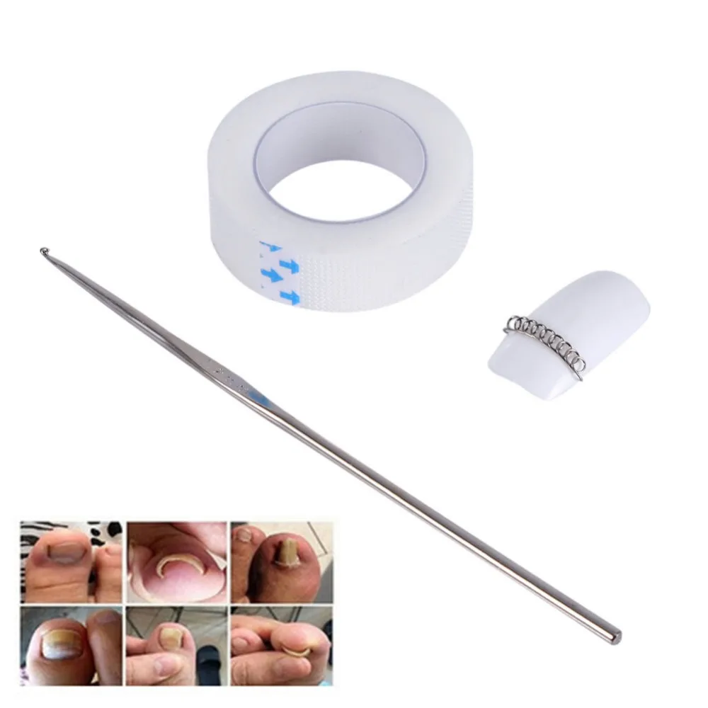 

3Pcs Ingrown Toe Nail Correction Pedicure Wire Fixer+Crochet Hook+Correction Sticker Kit Paronychia Recover Supplies Tool#255595