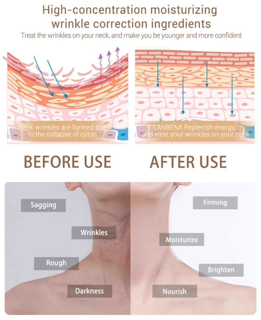 LANBENA отбеливание увлажняющий шеи электромассажер для лица против морщин увлажняющий крем маска для шеи уменьшить тонкие линии снятия Бережный уход за кожей