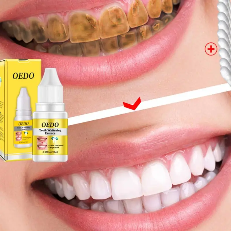 

10ml Dental Teeth Whitening Essence Liquid Oral Hygiene Cleaning Serum Gel Removes Plaque Stains Tooth Bleaching Beauty Tools