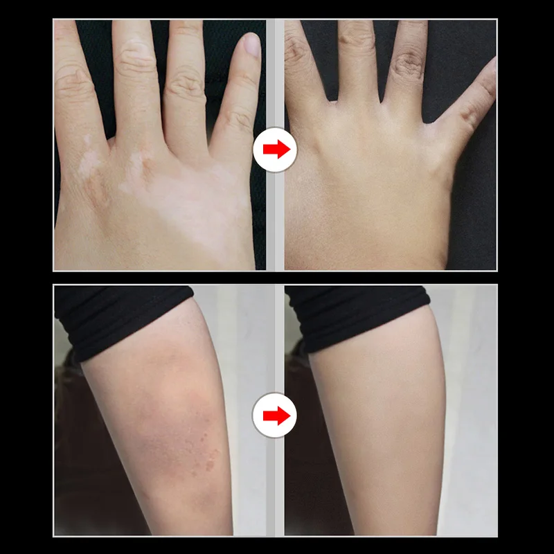 

NEW 2 Pcs Skin Make-up Concealer Cream Tattoo Scar Birthmark Cover-up Cream