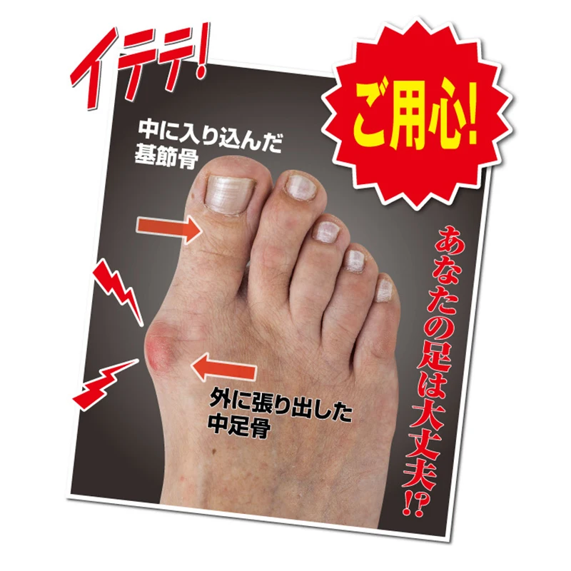 1 Pair Big Toe Sleeve Toe Separator Hallux Valgus Corrector Blackmailed Orthoses Corn Sleeve Foot Care Appliance
