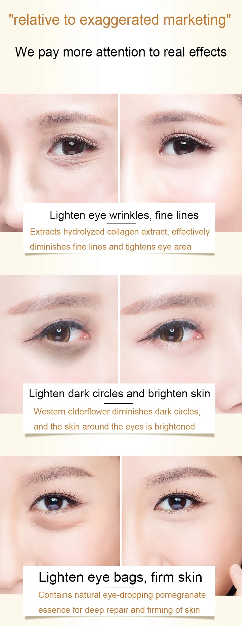 korean dark circles