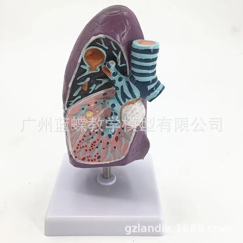 

Human Respiratory System Trachea and Lung Anatomical Pathology Medical Model