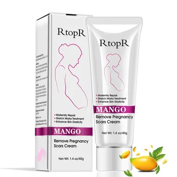 

Natural Mild Non-irritating Mango Stretch Mark Cream For Pregnancy Repair Scar Slack Line Abdomen Stretch Marks Cream